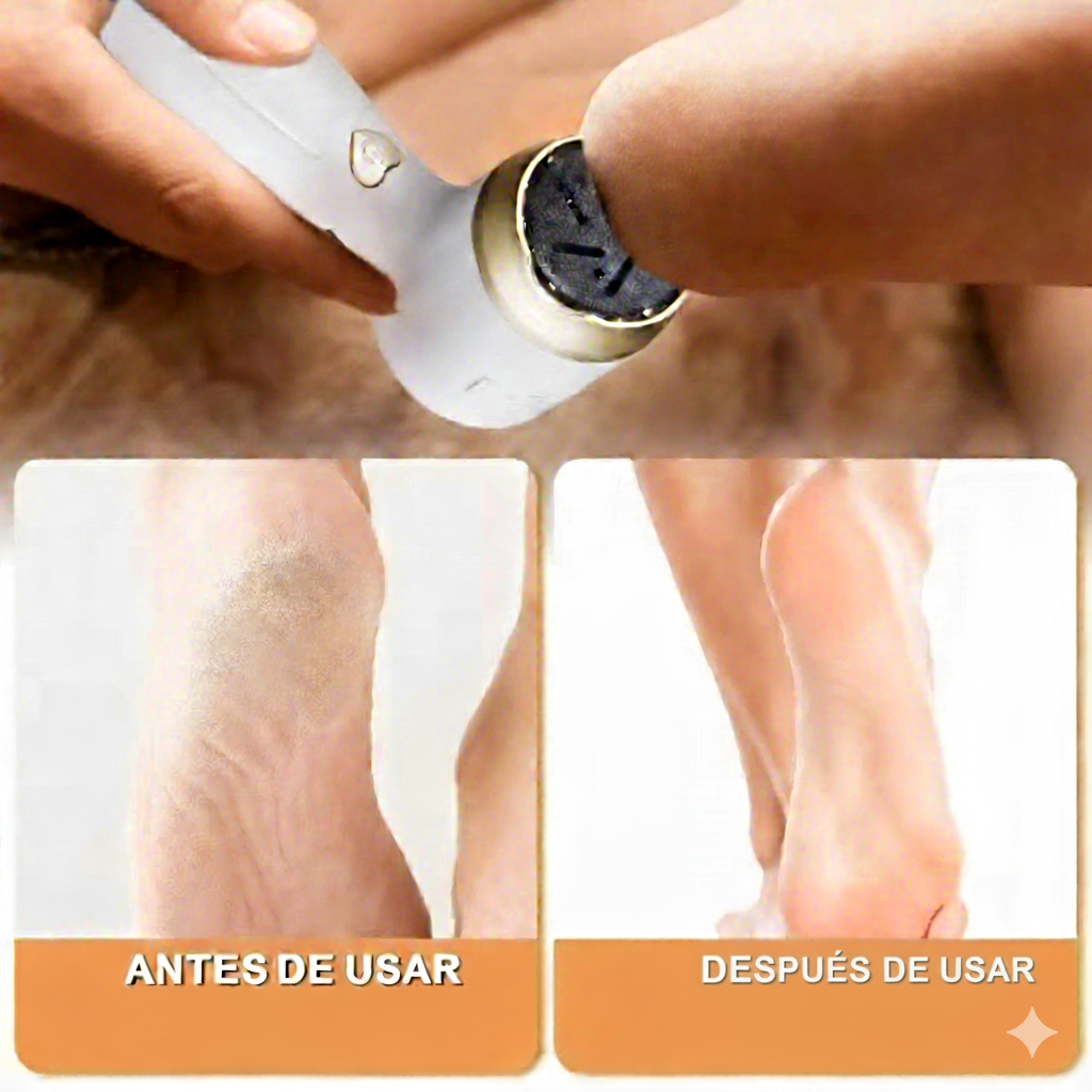 REMOVEDOR DE CALLOS - Imagen 3